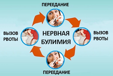 Лечение булимии в Никеле